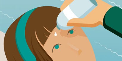 VOUS N'EN CROIREZ PAS VOS YEUX ! ASTUCES CONCERNANT LES BLESSURES OCULAIRES